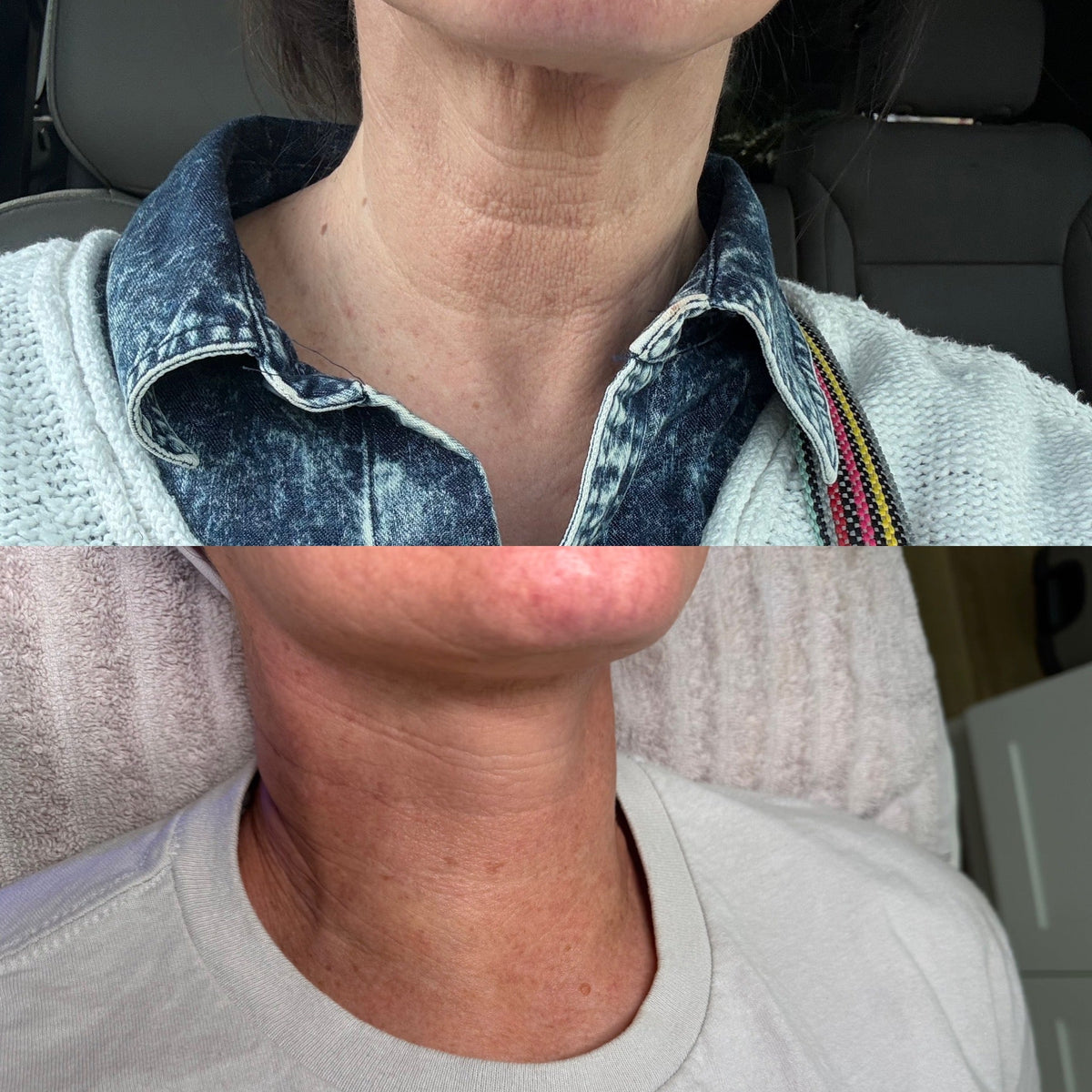 Neck Complex Anti-Aging + Brightening Serum ZO