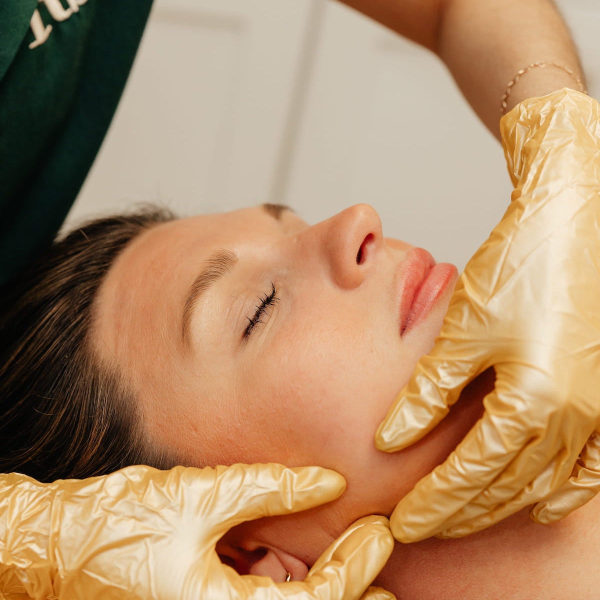 chemical peels near me
