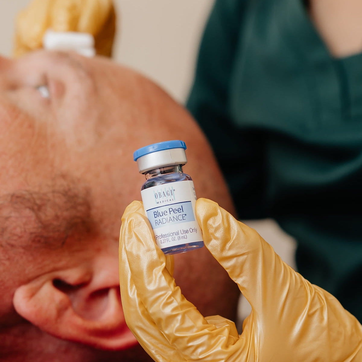 chemical peels near me