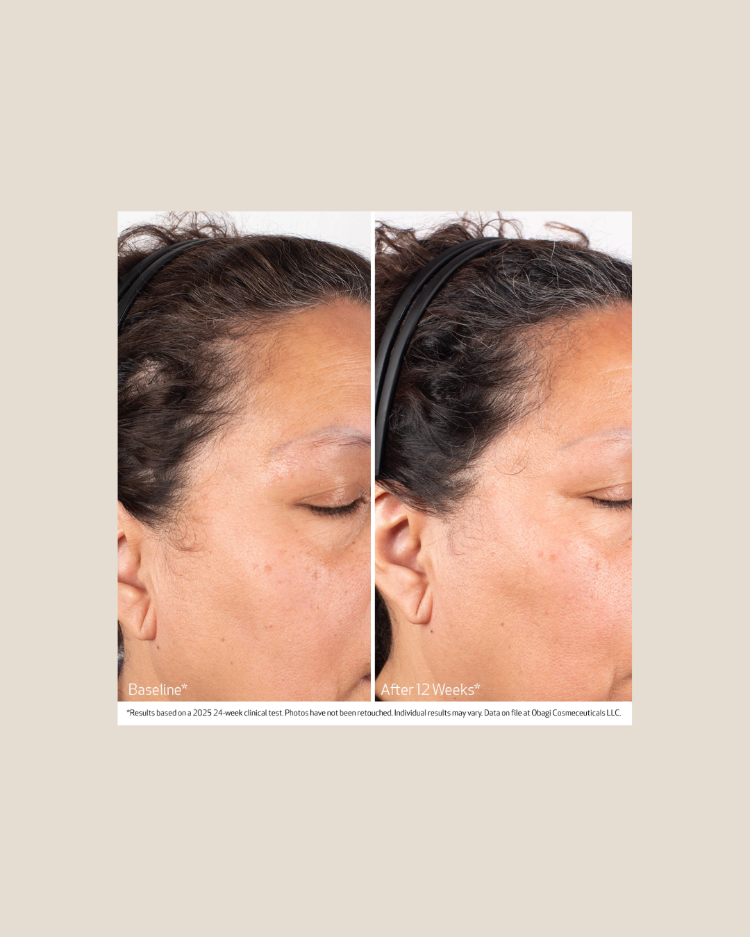 BIOSTIM™ SCALP SERUM Obagi