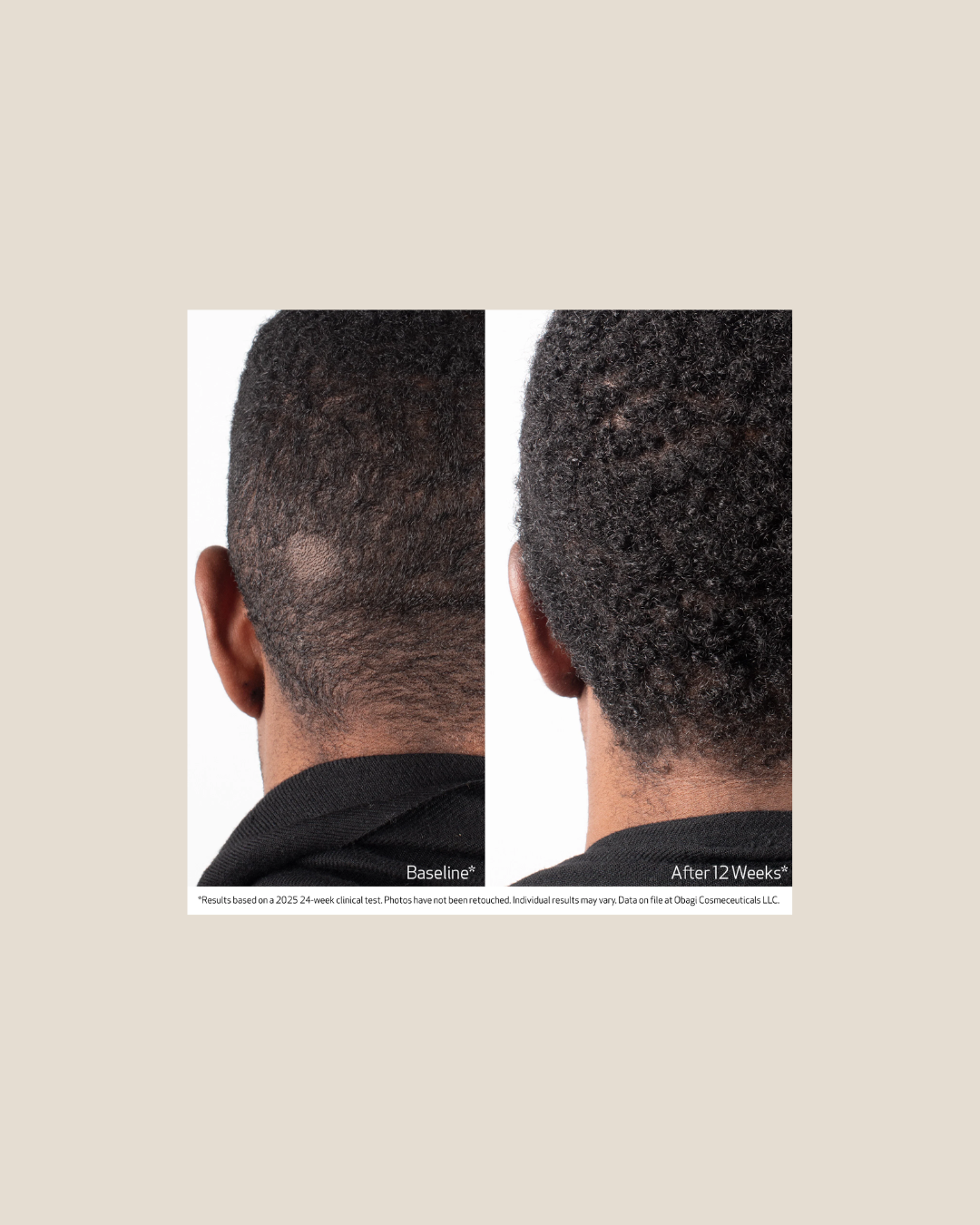 BIOSTIM™ SCALP SERUM Obagi